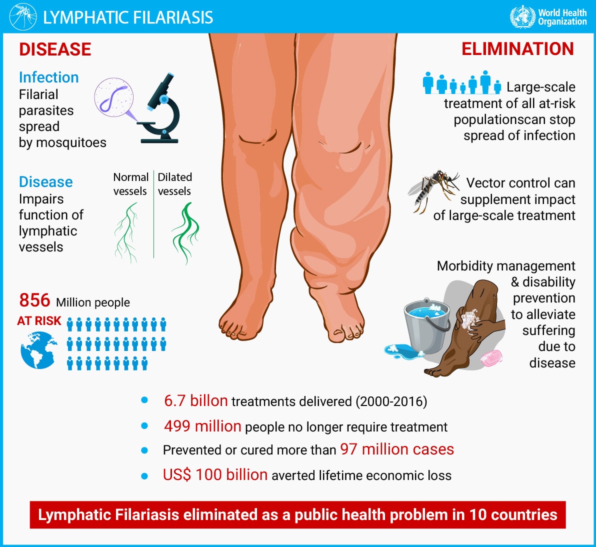 Full size Lymphatic filariasis infographic